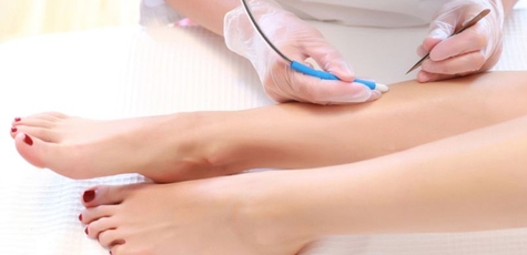 Body electrolysis in the office «Love Epil»