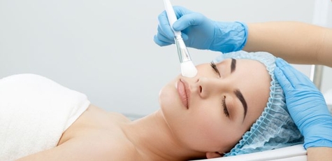 Up to 5 Facial Peeling Sessions in «Beauty Room»