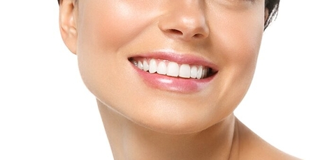 Teeth Whitening with Cleaning at «Royal Dent»