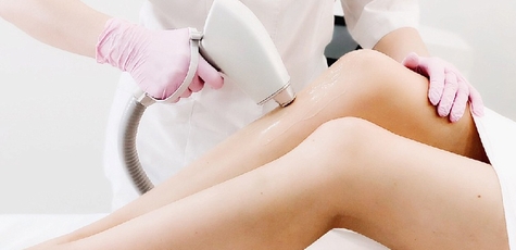 Up to 5 Laser Hair Removal Sessions at Olgabeauty