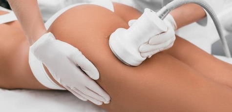 Up to 3 Sessions of Anti-Cellulite Massage