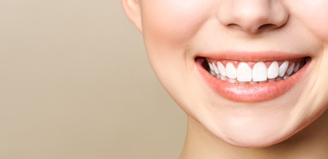 Discount on LED teeth whitening at Avicenna Dent