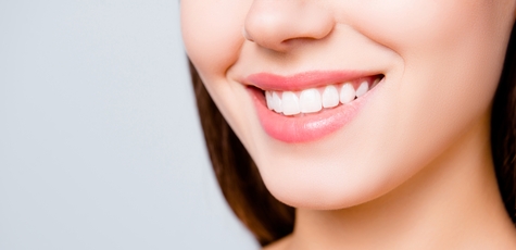 Discount on Veneers Installation at Avicenna Dent