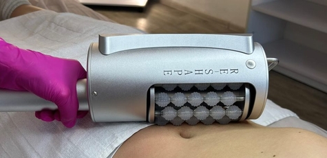 До 10 сеансів ендосфера-терапії тіла у «Keep fit»