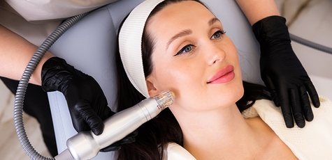 Discount on microneedle RF-lifting in Krasa Lab