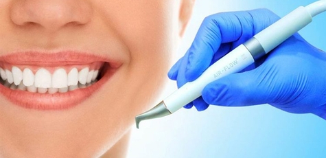 Ultrasonic teeth cleaning in Profident