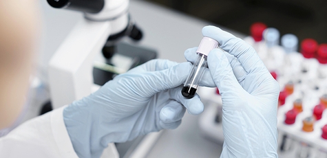 Antibody or antigen test for Covid-19