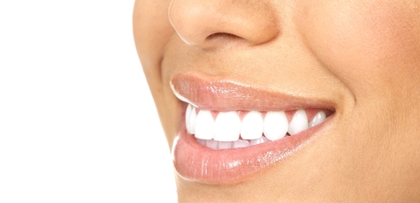 Чистка зубів з Air-Flow від Аліни Костенко