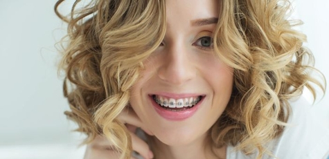 Скидка на установку брекетов