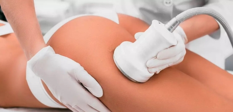 До 7 сеансов вакуумно-роликового термо-массажа