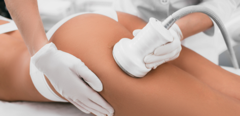 Up to 3 cavitation sessions at Beauty Choice