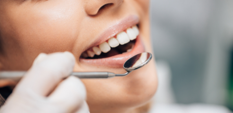 Чистка зубів у кабінеті Олени Віталіївни