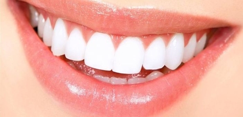 Discount on Crown Installation at Genius Dental