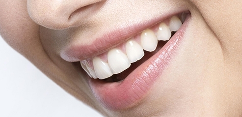 Чистка зубов в клинике «Holosko Dental Center»