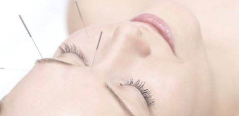 Up to 7 sessions of acupuncture at Volynchuk