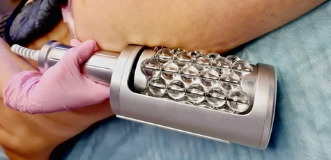Up to 3 sessions of body endospheres at BodyLike