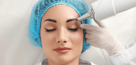 Up to 3 eyebrow tattoo removals at Ishchenko